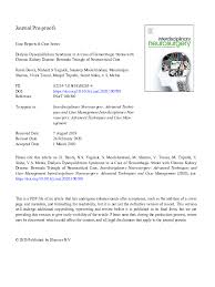 Image result for Dysequilibrium