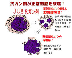 「抗がん剤」の画像検索結果