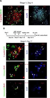 Type 1 diabetes (t1d), previously known as juvenile diabetes, is an autoimmune disease that is a form of diabetes in which very little or no insulin is produced by the islets of langerhans. Adult Pancreas Generates Multipotent Stem Cells And Pancreatic And Nonpancreatic Progeny Choi 2004 Stem Cells Wiley Online Library