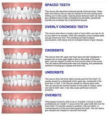 Pin On Impressions Orthodontics