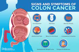 Some of these colon cancer symptoms can be caused by other conditions such as infections, irritable bowel syndrome, hemorrhoids, inflammatory bowel disease and not necessarily colon cancer. Colon Cancer Symptoms Causes And Support Strategies