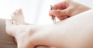Les points noirs, connus également sous le nom de comédons, apparaissent généralement sur la zone t du visage, à savoir du front, au menton en passant évidemment par le nez. Epilation Comment Eviter Les Points Noirs De La Repousse Fourchette Bikini