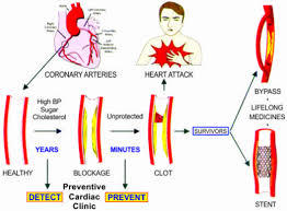 heart flow chart safe health heart centre