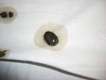 Managing constipation in adults - Australian Prescriber