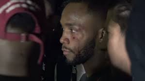 Jorge masvidal and leon edwards appear to be on a collision course at some point in the future a backstage fight a few months ago between jorge masvidal and leon edwards has led to one of the. Edwards Suffers Cut In Backstage Fight With Masvidal Espn Video