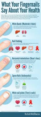 What Nails Say About Your Health Fingernail Health Nail Health Health Remedies