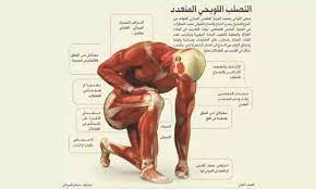 موضوع عن الماء بالانجليزي واهميته مع الترجمة، نساعدك في كتابة تعبير او برجراف قصير أومقال عن الماء، وايضا تعبير للصف الثالث الثانوي عن الماء وكيفية الحفاظ عليه. Ø§Ù„ØªØµÙ„Ø¨ Ø§Ù„Ù„ÙˆÙŠØ­ÙŠ Ø§Ù„Ù…ØªØ¹Ø¯Ø¯ Ø³ÙˆØ±ÙŠØ© Ø­Ù„Ø¨ Posts Facebook