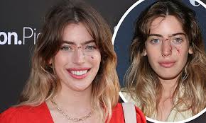 Ewan McGregor's daughter Clara proudly displays her healing dog bite wounds  at film premiere in LA