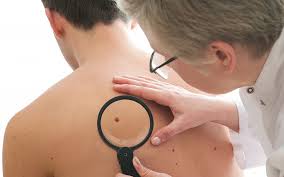 In more rare cases it can appear in the eye or bowel. Israeli Researchers Say Fat Cells Under Skin Help Melanoma Turn Lethal The Times Of Israel