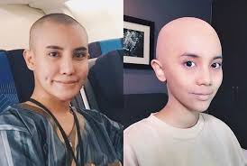 View casting suggestions for farhanna qismina, and make your own suggestions for roles you think they should play farhanna qismina also credited by her stage name sweet, is a malaysian actress. Netizens Compare Sweet Qismina S Bald Look To Safiey Ilias Hype Malaysia