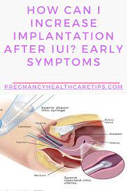 Pin On Pregnancy