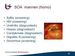 We did not find results for: Soa S Niet In Mijn Praktijk Of Toch Ppt Video Online Download