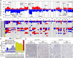 A prognosis can range in severity, though most mesothelioma diagnoses are generally poor. Bap1 Haploinsufficiency Predicts A Distinct Immunogenic Class Of Malignant Peritoneal Mesothelioma Genome Medicine Full Text