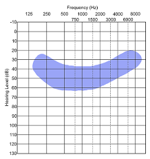 What Is An Audiogram Understanding Hearing Test Results