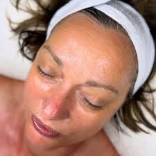 The Super-Smoother ✨ This treatment removes the top layer of dead skin  cells to improve texture, reduce congestion, and enhance product  absorption. ✓ Smoother surface ✓ Brighter tone ✓ Better skin health