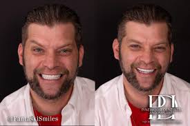 Testimonial! “Dr Tyrone Bishop and his team are absolutely incredible! I  was terrified of getting a root canal, but they are calm and reassuring  demeanor immediately put me at ease. The procedure