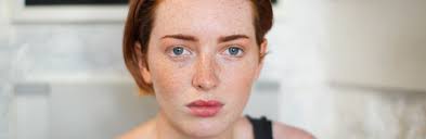 Kalista Medical Aesthetic Clinic Fordingbridge Ringwood Salisbury Hampshire