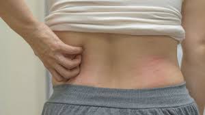 Check spelling or type a new query. Deretan Penyebab Kulit Gatal Saat Sakit Liver Apa Saja