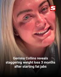 The weight is falling off!