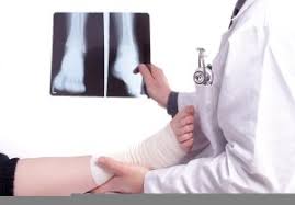We are an accredited health provider so you can claim our fees from your private health insurance. Myths About X Rays And Running Injuries
