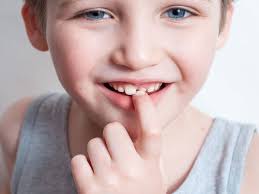 Dec 02, 2020 · don't try to pull a tooth that isn't ready because it could cause excessive bleeding and affect the position of permanent teeth coming in. Tips For Getting A Baby Tooth To Wiggle Out Greater Houston Pediatric Dentistry