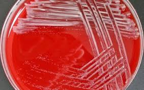 Image result for Rhizobium radiobacter, syn. Agrobacterium tumefaciens