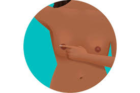 The epidemiology, clinical features, treatment, and prognosis of ibc will be reviewed here. 7 Breast Cancer Symptoms You Need To Know