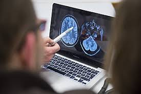 Die multiple sklerose ist eine autoimmunerkrankung, die von patient zu patient sehr unterschiedlich verlaufen kann. Mrt Diagnose Erleichtert Medizin Therapie Multiple Sklerose News Amsel E V