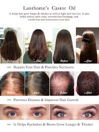 Castor oil also grows your hair thicker stronger and longer. Castor Oil Pakistan In Bulk For Hair Set Buy Castor Oil Pakistan Castor Oil In Bulk Castor Oil For Hair Set Product On Alibaba Com