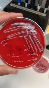 Columbia cna agar + 5% sheep blood. Pin On Lab