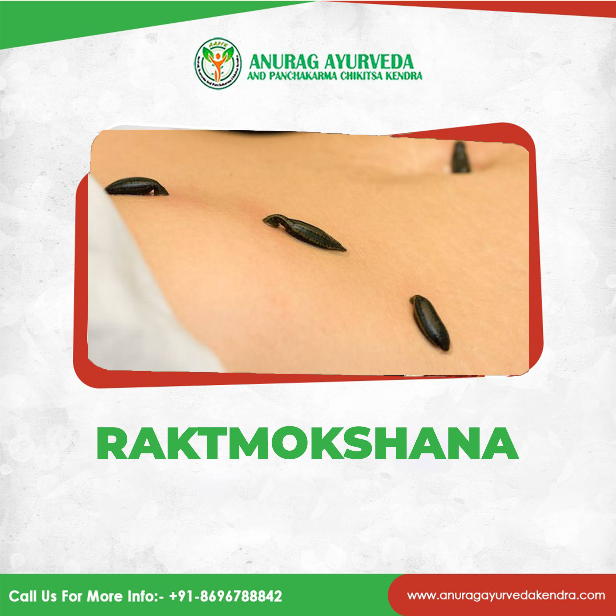 Raktmokshana – shiravedh product image