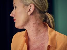 Charlie Veech remembered after fatal Carinda crash