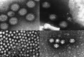 Read about gastroenteritis (stomach flu): Viruses Causing Gastroenteritis Clinical Microbiology And Infection