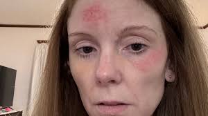 Fundraiser by Amy Jump : Support for Amy's medical procedures and housing.