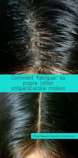Pin On Faire Pousser Les Cheveux