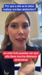 ¿Por qué es necesaria una Lipo Abdominoplastia en casos de diástasis  abdominal?