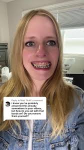 Replying to @Matt Thrift I get a lot of questions about whether I eat with  my #elastics in! #braces #orthodontics #keepingitreal #fyp