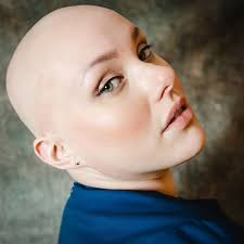 The pandemic made me embrace my alopecia
