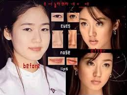 Home botox keith urban plastic surgery. Korea Is Obsessed With Plastic Surgery