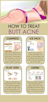 Pin On Acne Remedies