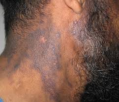The Pan African Medical Journal Image Quiz