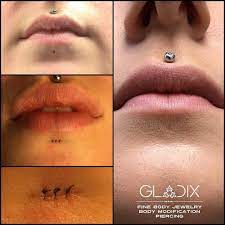 Encombre E Par La Trace D Un Vieux Piercing Que Vous Vivez Comme Disgracieuse Si C Est Le Cas Gladix Porca Miseria Peut Vous Aider Labret Piercing Cicatrice