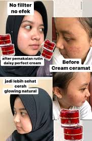 DAISY PERFECT CREAM by WINDKA GLOW with Niacinamide/ DAISY PERFECT CREAM 2  IN 1/ CREAM SIANG DAN MALAM DAISY PERFECT CREAM