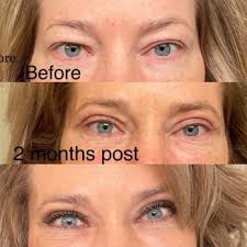 LORNE K ROSENFIELD, MD