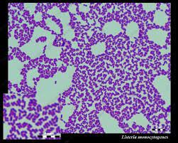 The listeria monocytogenes pathogenic bacteria. Susceptibility Of Listeria Monocytogenes To Antibiotics Susceptibility To Ampicillin
