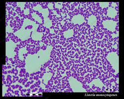 Under a microscope the bacterial cells can easily be seen moving about with a characteristic tumbling motion. Susceptibility Of Listeria Monocytogenes To Antibiotics Susceptibility To Ampicillin