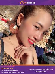 Liên tiếp những feedback độn cằm của KH gửi về cho bác sĩ!