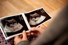Ultrasound Signs For Determining Baby S Sex
