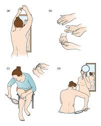 Image result for Self Skin Exam