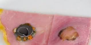 Disturbing Video Shows How Dangerous It Is When A Child Swallows A Battery Self